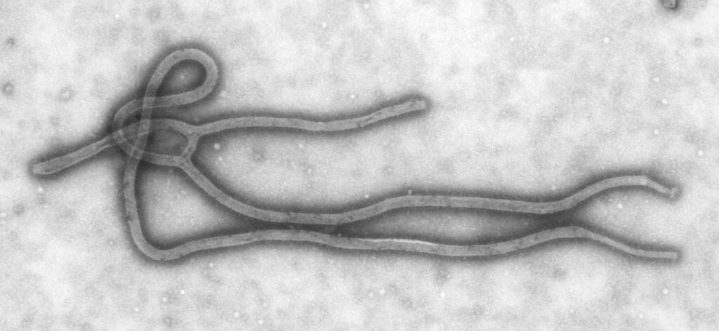 Imagem de microscopia eletrônica do vírus ebola, em forma de filamentos longos e entrelaçados
