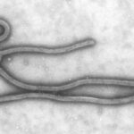 Imagem de microscopia eletrônica do vírus ebola, em forma de filamentos longos e entrelaçados