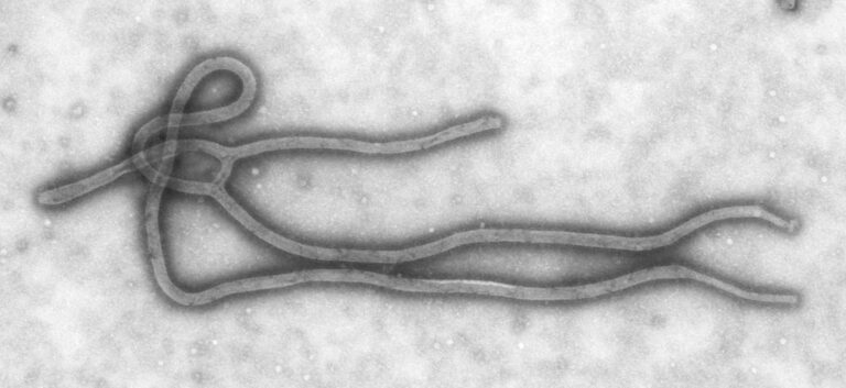 Imagem de microscopia eletrônica do vírus ebola, em forma de filamentos longos e entrelaçados